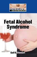 Fetal_Alcohol_Syndrome