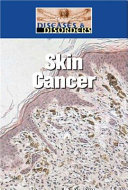 Skin_cancer
