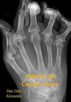 Arthritis_and_Common_Sense