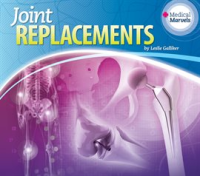 Joint_Replacements